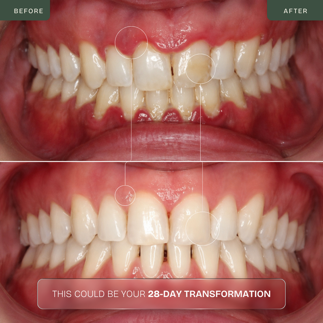 Escova de dentes elétrica 2 em 1 com LED